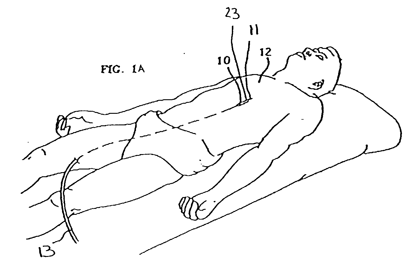 Figure 00000001