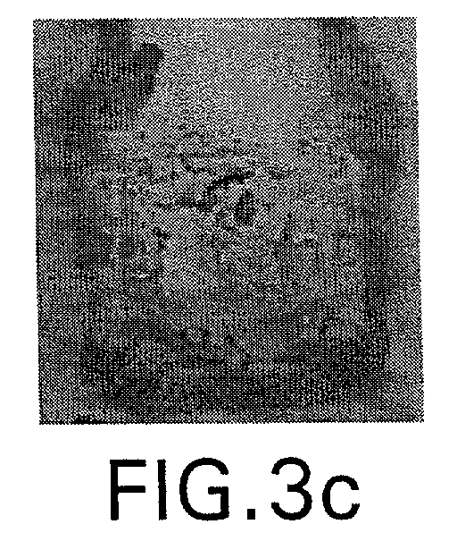 Figure 00000005