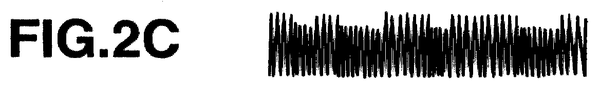 Figure 00000003
