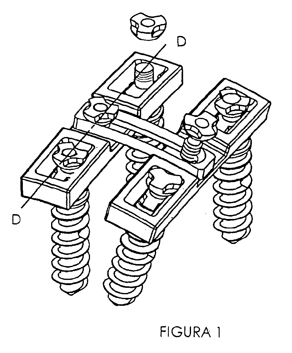 Figure 00000001