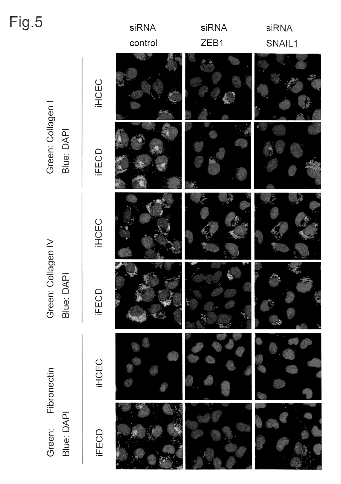 Woa1 角膜内皮ecm治療薬 Google Patents Woa1 角膜内皮ecm治療薬 Google Patents