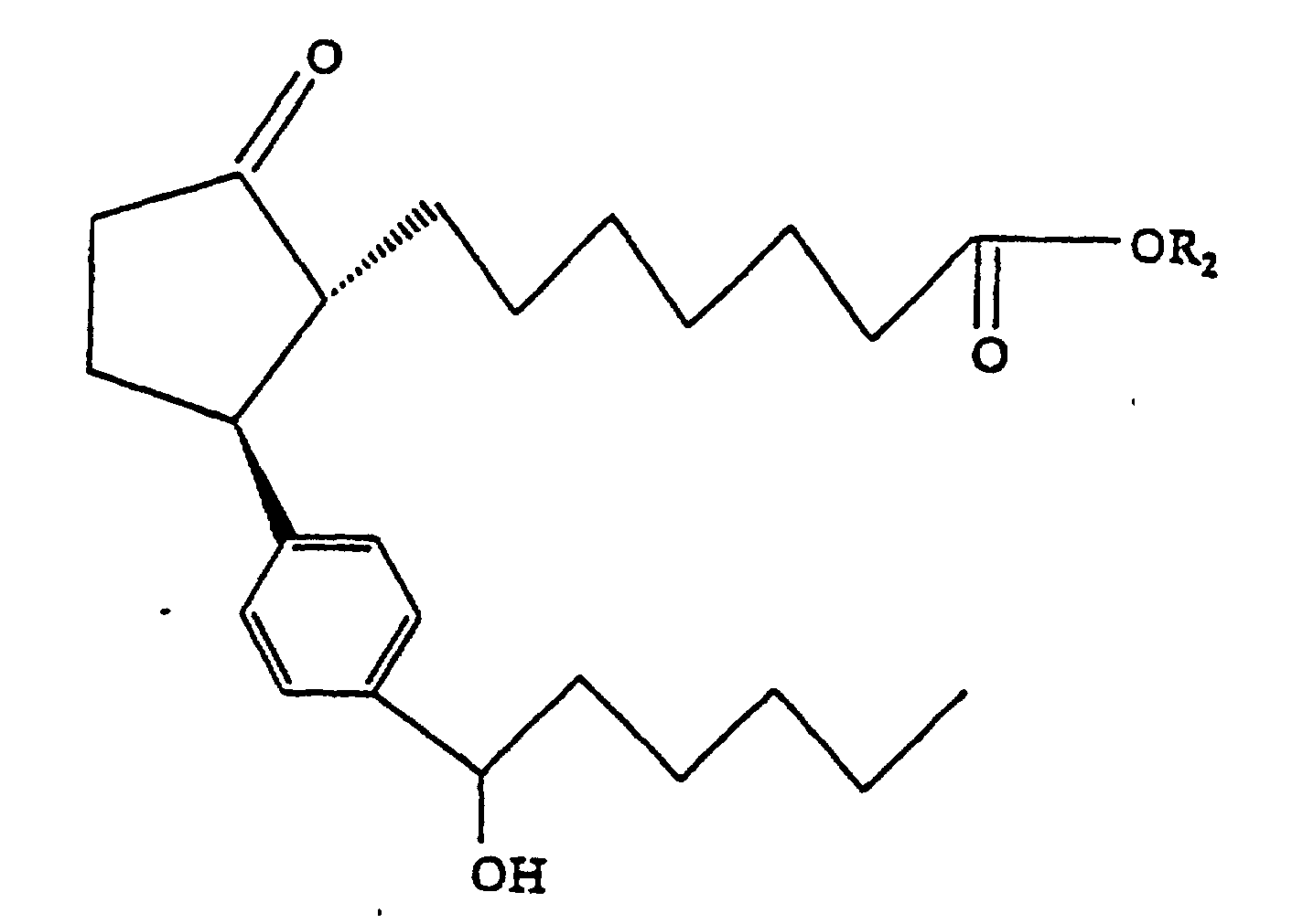 Figure 00170001