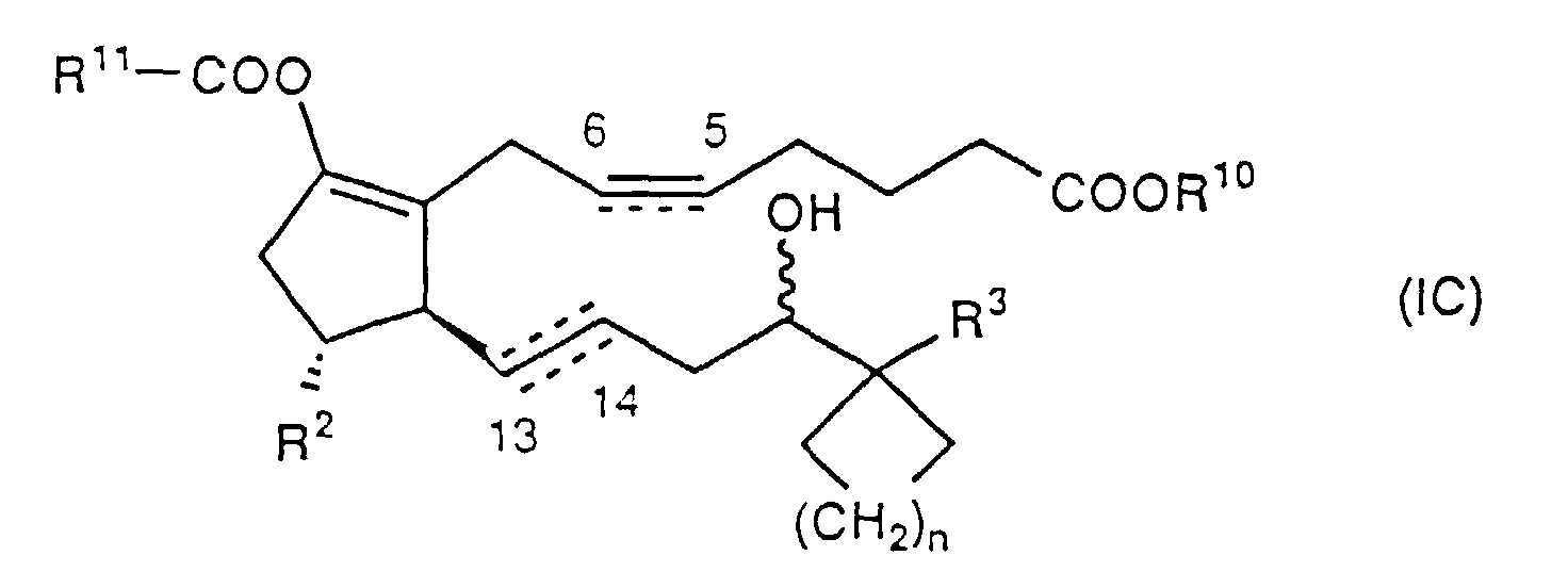 Figure 01420001