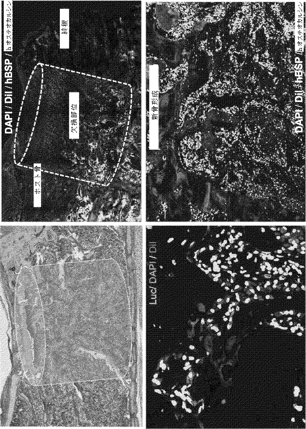 Jpa 脊椎圧迫骨折の非外科的修復のための方法 Google Patents