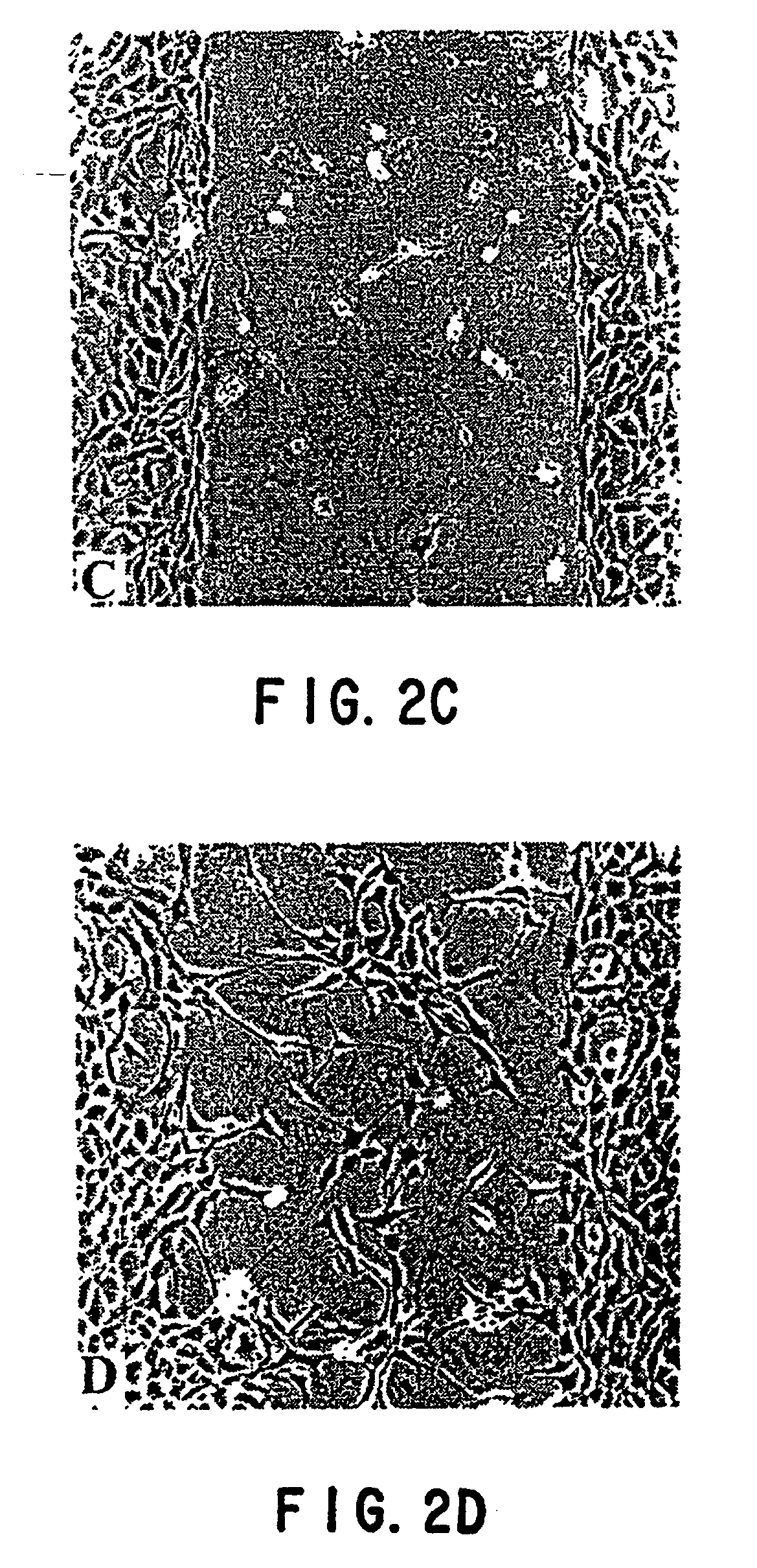 Epb1 Alginate Containing Medicament And Implant For Treating Fibrosis Google Patents