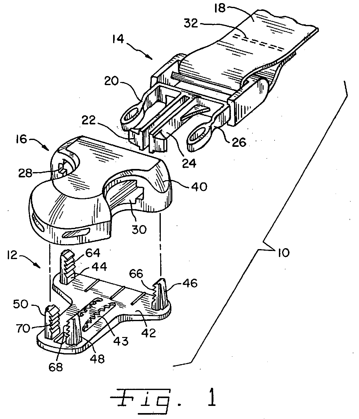 Figure 00000001