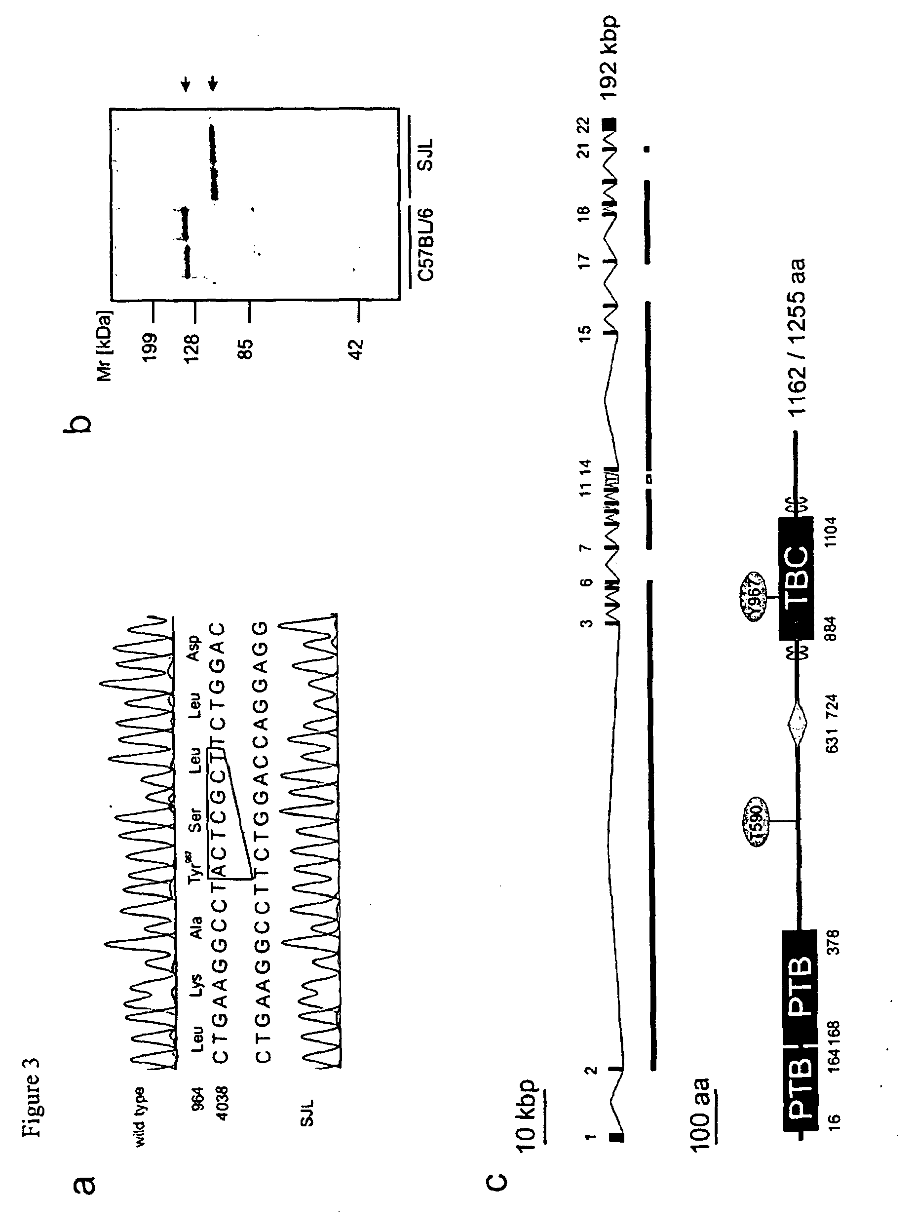 tbc1d1 diabetes mellitus