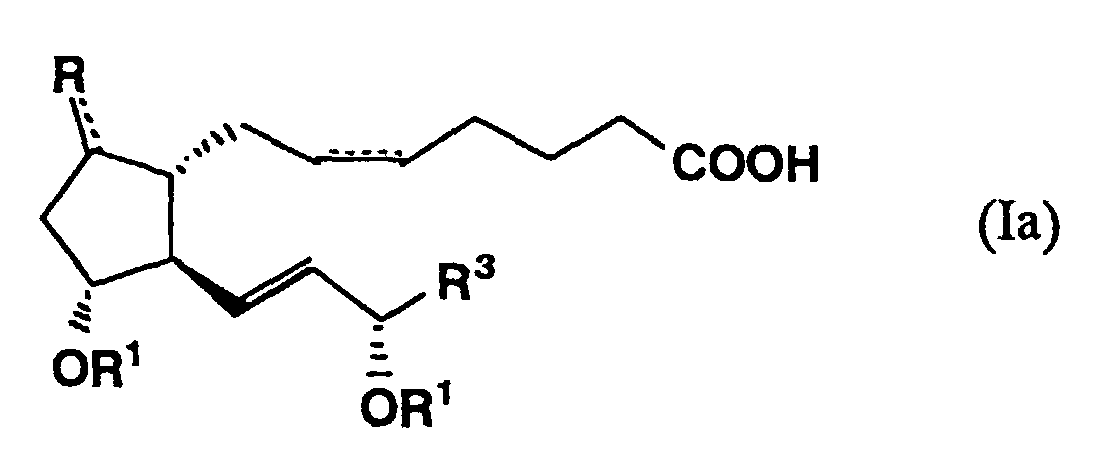 Figure 00110001
