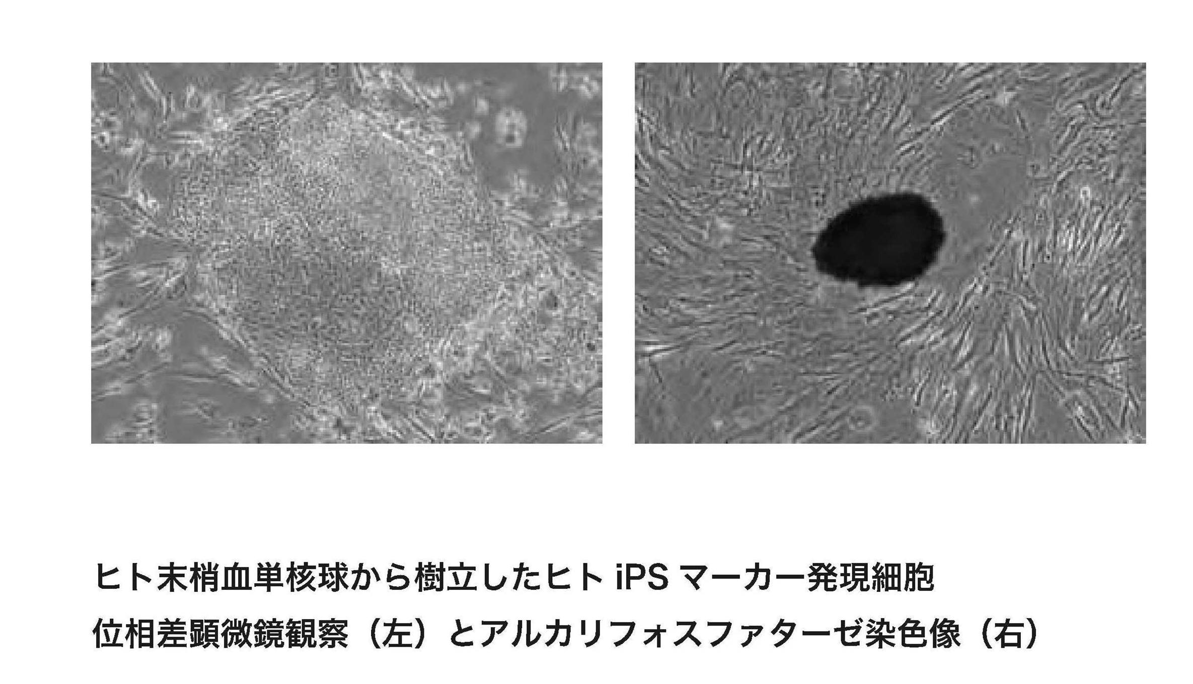 Wo2012063817a1 末梢血単球由来多能性幹細胞作製方法 Google Patents