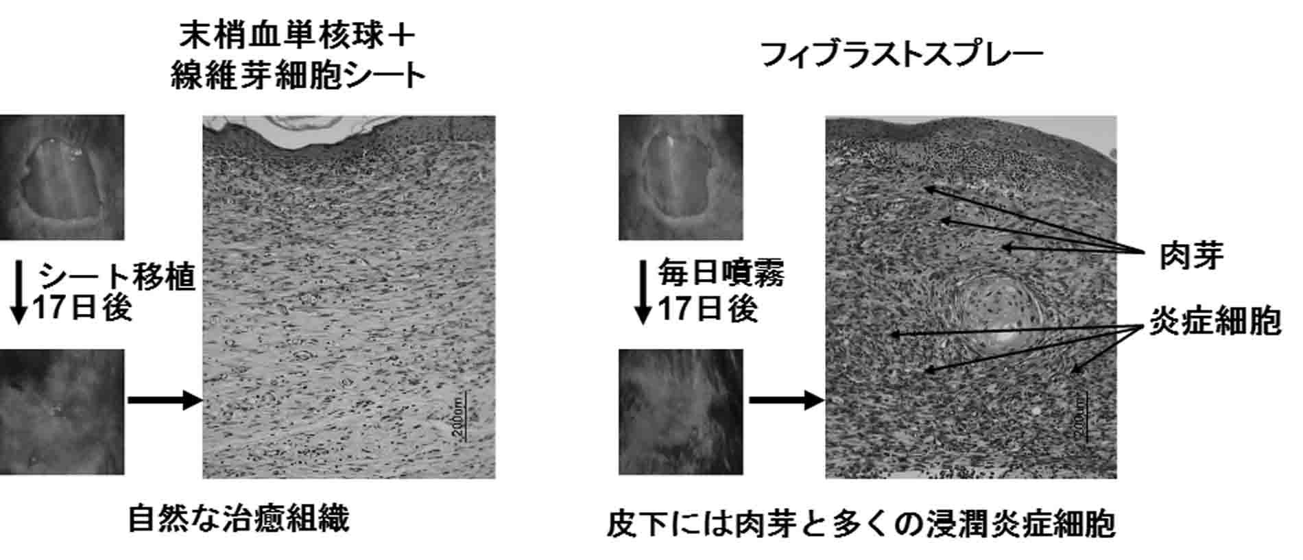Wo2016068217a1 Cell Sheet Containing Peripheral Blood Mononuclear Cells Or Fibroblasts Associated With Factor Secreted By Peripheral Blood Mononuclear Cells Google Patents
