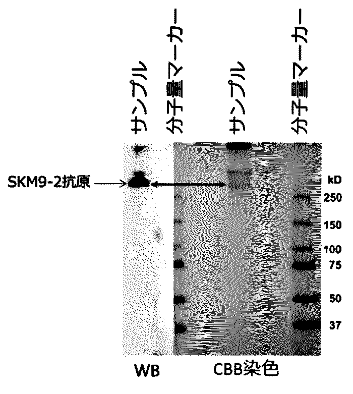Wo2017141604a1 膜型ムチン様タンパク質の認識とその医療応用 Google Patents
