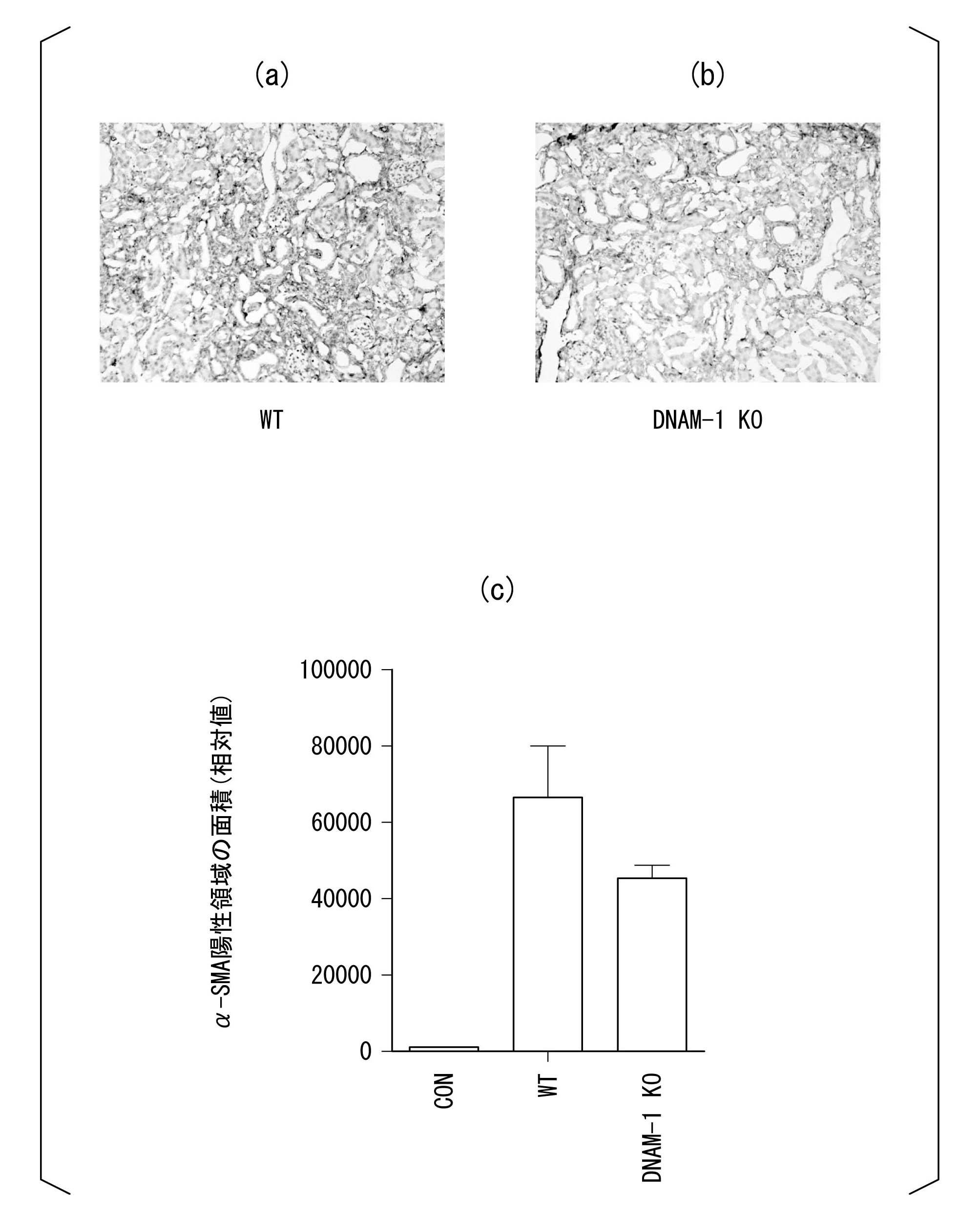 Wo2017183665a1 制御性ｔ細胞の活性化剤及びその使用 Google Patents