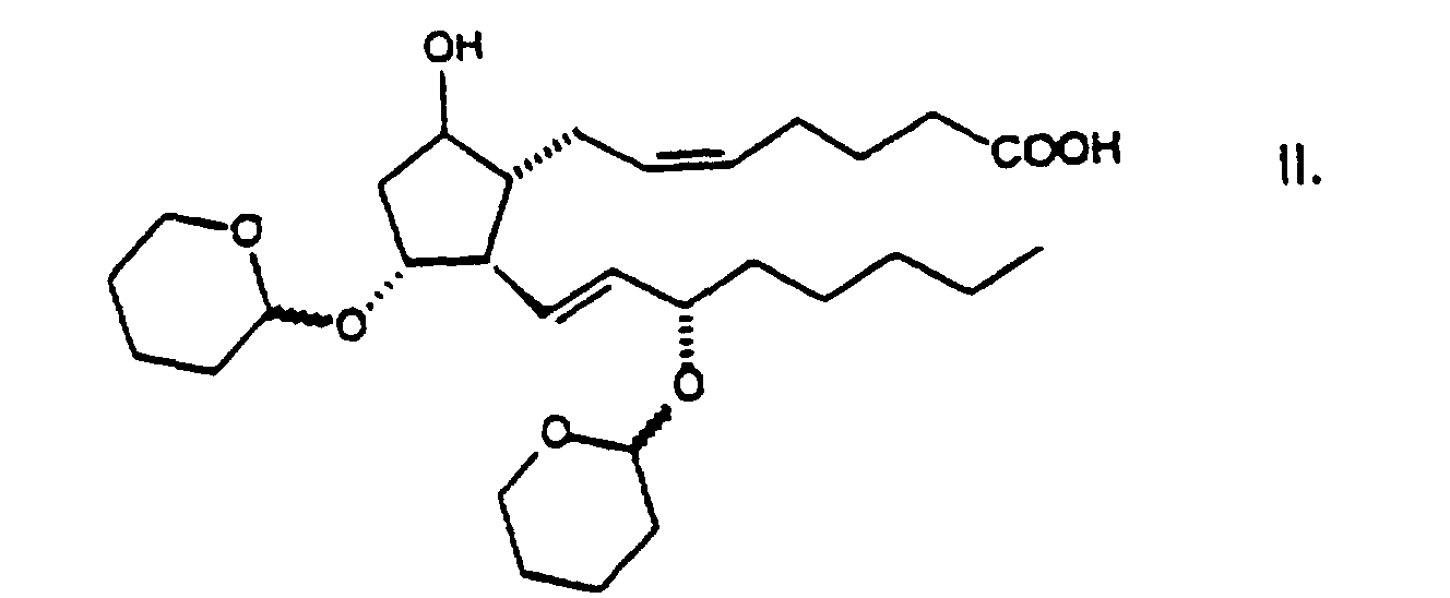 Figure 00060002