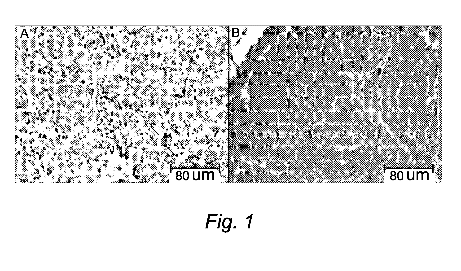 tumore prostata 1 cm code