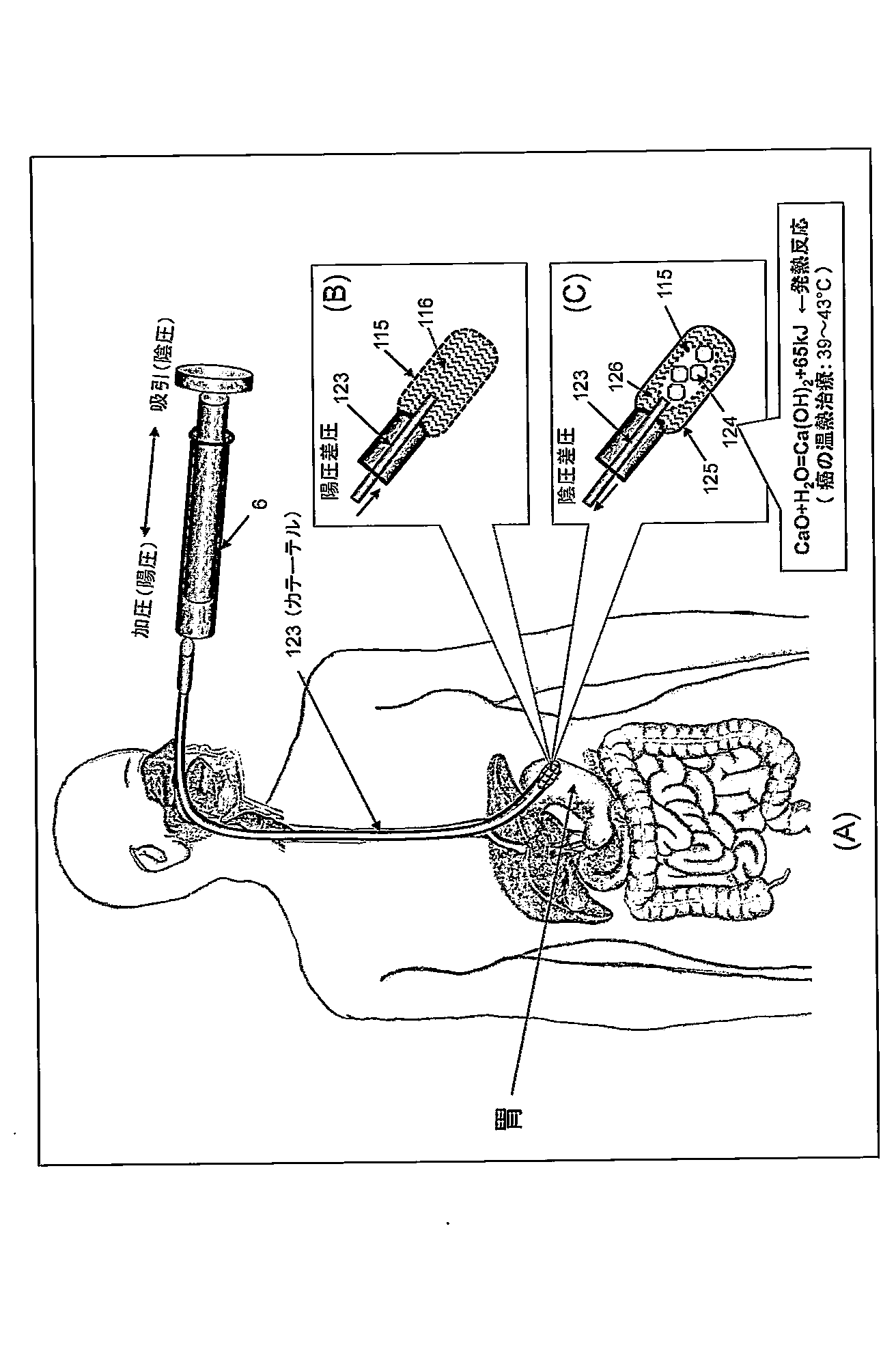 Wo2015034088a1 撥液性多孔質膜を備えた電気化学反応装置 Google Patents