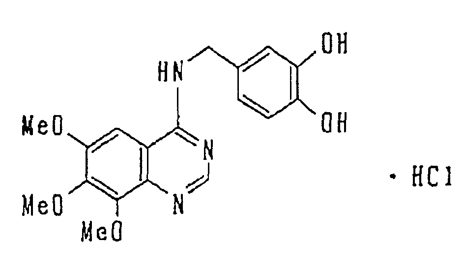 Figure 01990001