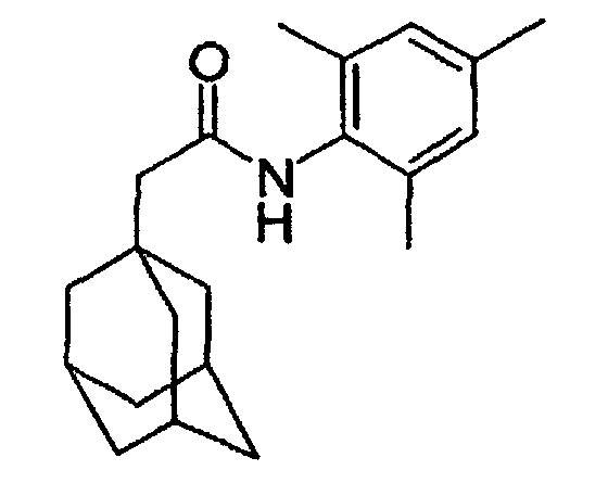 Figure 00340001