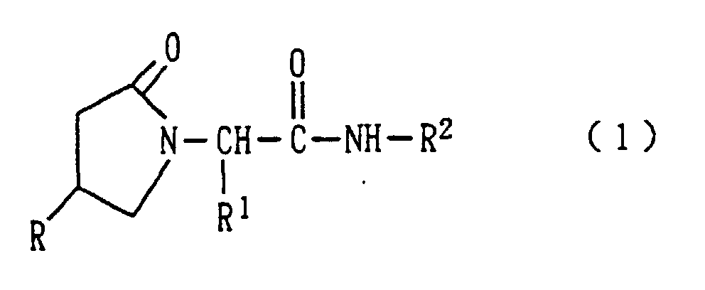 Figure 00920001
