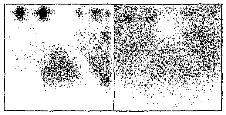 Figure imgf000005_0004
