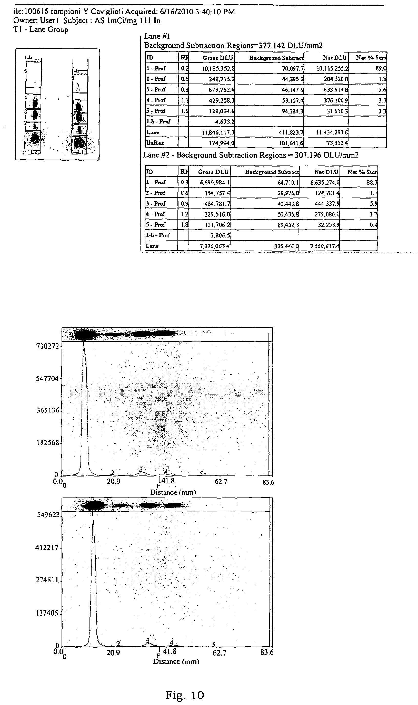 Epb1 A Conjugate Of Human Albumin And 2 4 Isothiocyanatobenzyl 1 4 7 10 Tetraazacyclododecane 1 4 7 10 Tetraacetic Acid Useful For The Localization Of Radionuclides For Diagnostic And Therapeutic Purposes Google Patents Epb1 A Conjugate Of Human Albumin And 2 4 Isothiocyanatobenzyl 1 4 7 10 Tetraazacyclododecane 1 4 7 10 Tetraacetic Acid Useful For The Localization Of Radionuclides For Diagnostic And Therapeutic Purposes Google Patents