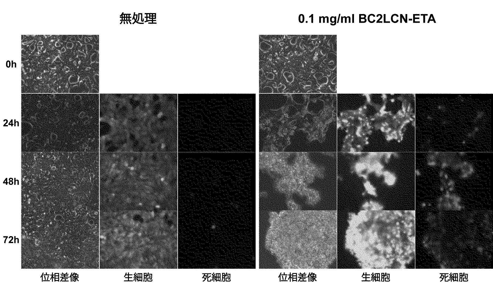 Wo2017061449a1 がん細胞の検出方法 がん細胞内に物質を導入するための試薬 及びがん治療用組成物 Google Patents