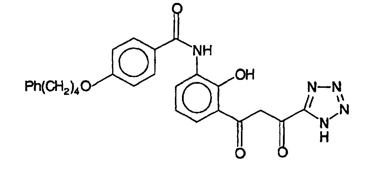 Figure 00170004