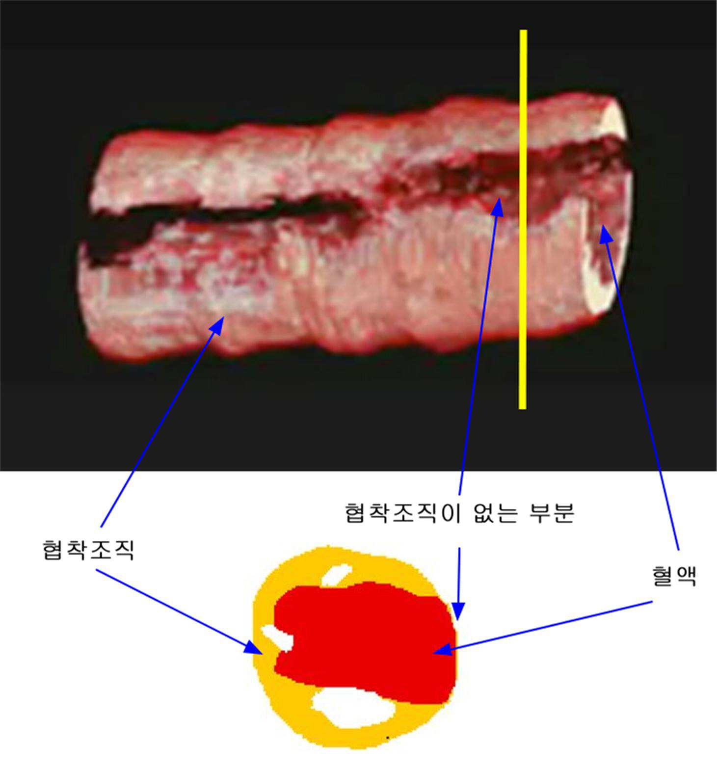 특허 도면 6