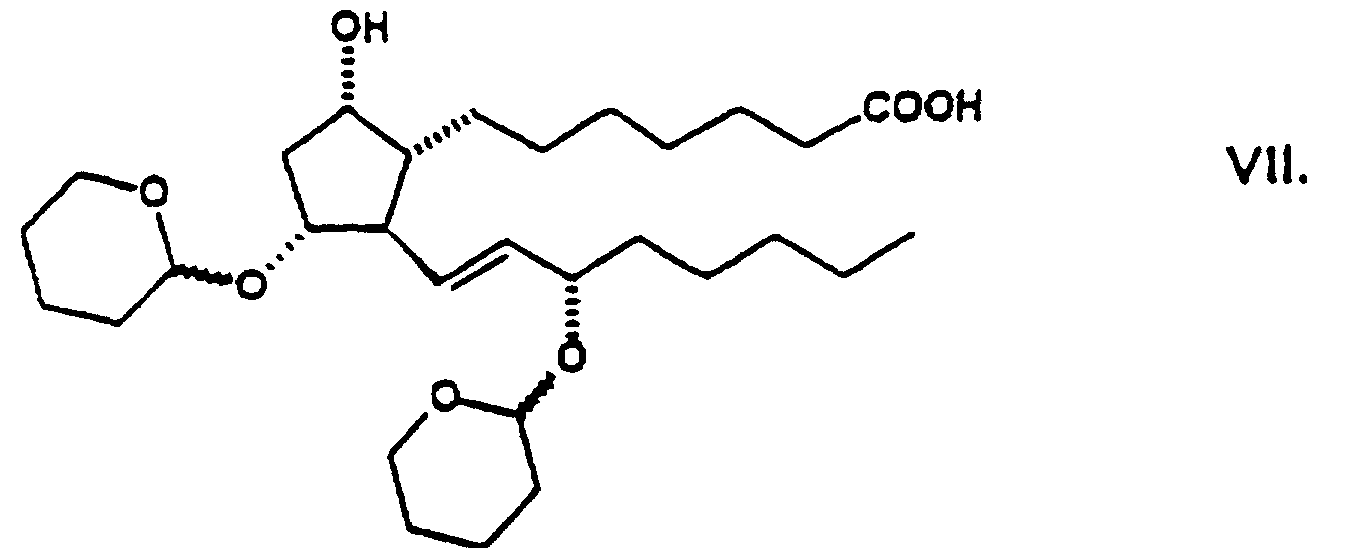 Figure 00060003