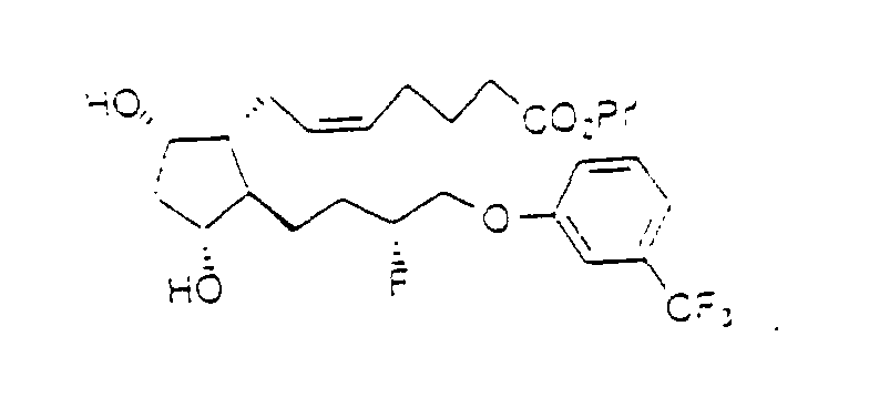 Figure 00500001