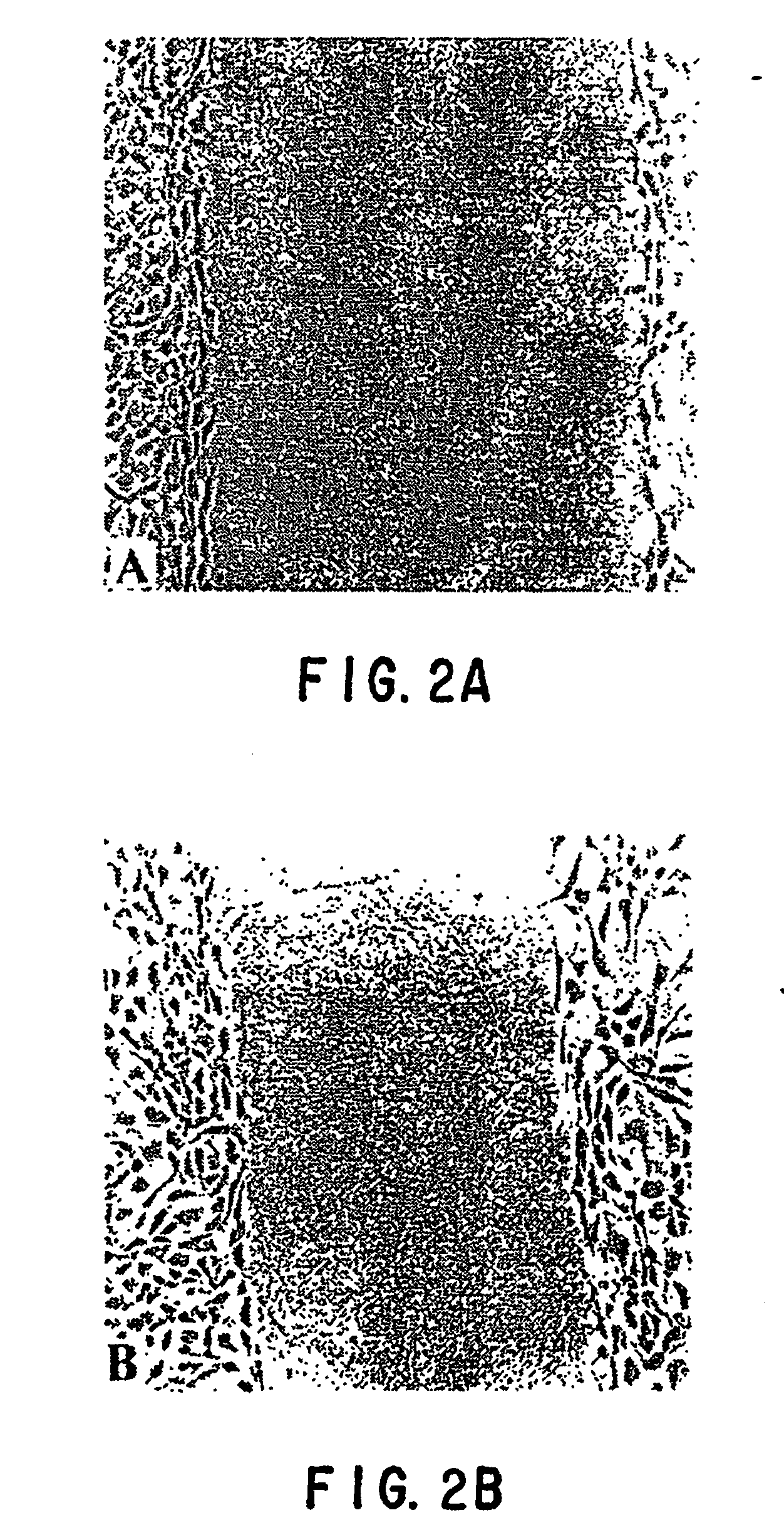 Epb1 Alginate Containing Medicament And Implant For Treating Fibrosis Google Patents