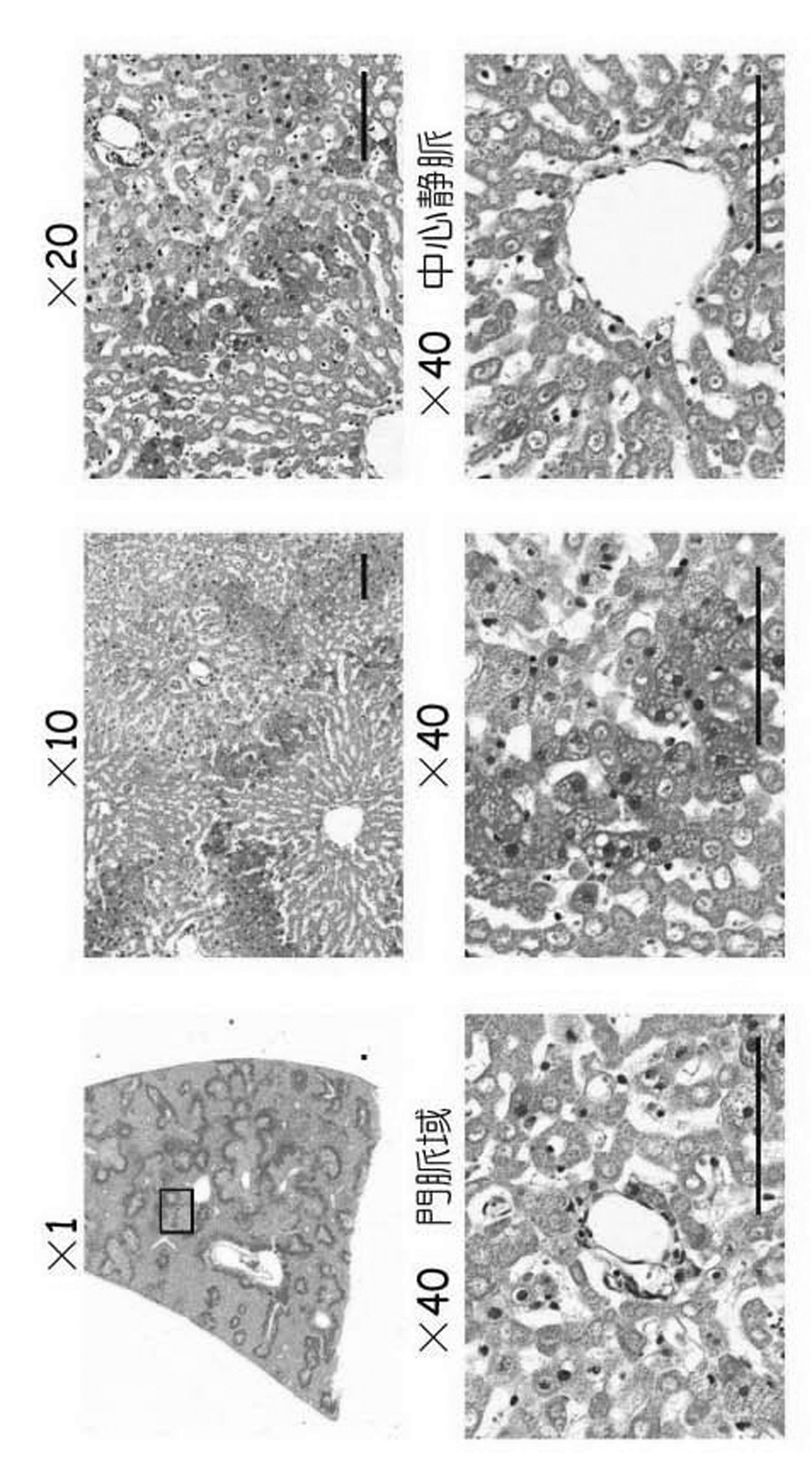 Woa1 移植のための臓器又は組織の長期維持方法 Google Patents