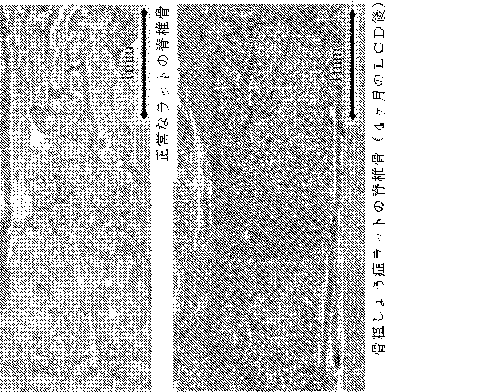 Jpa 脊椎圧迫骨折の非外科的修復のための方法 Google Patents