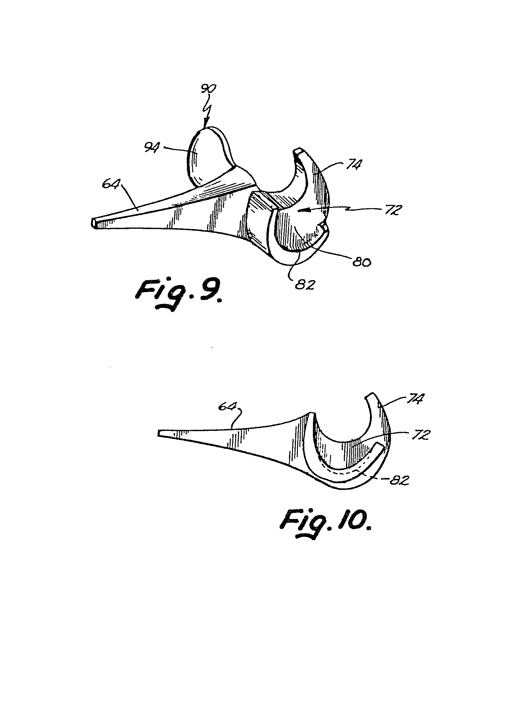 elbow joint prosthesis