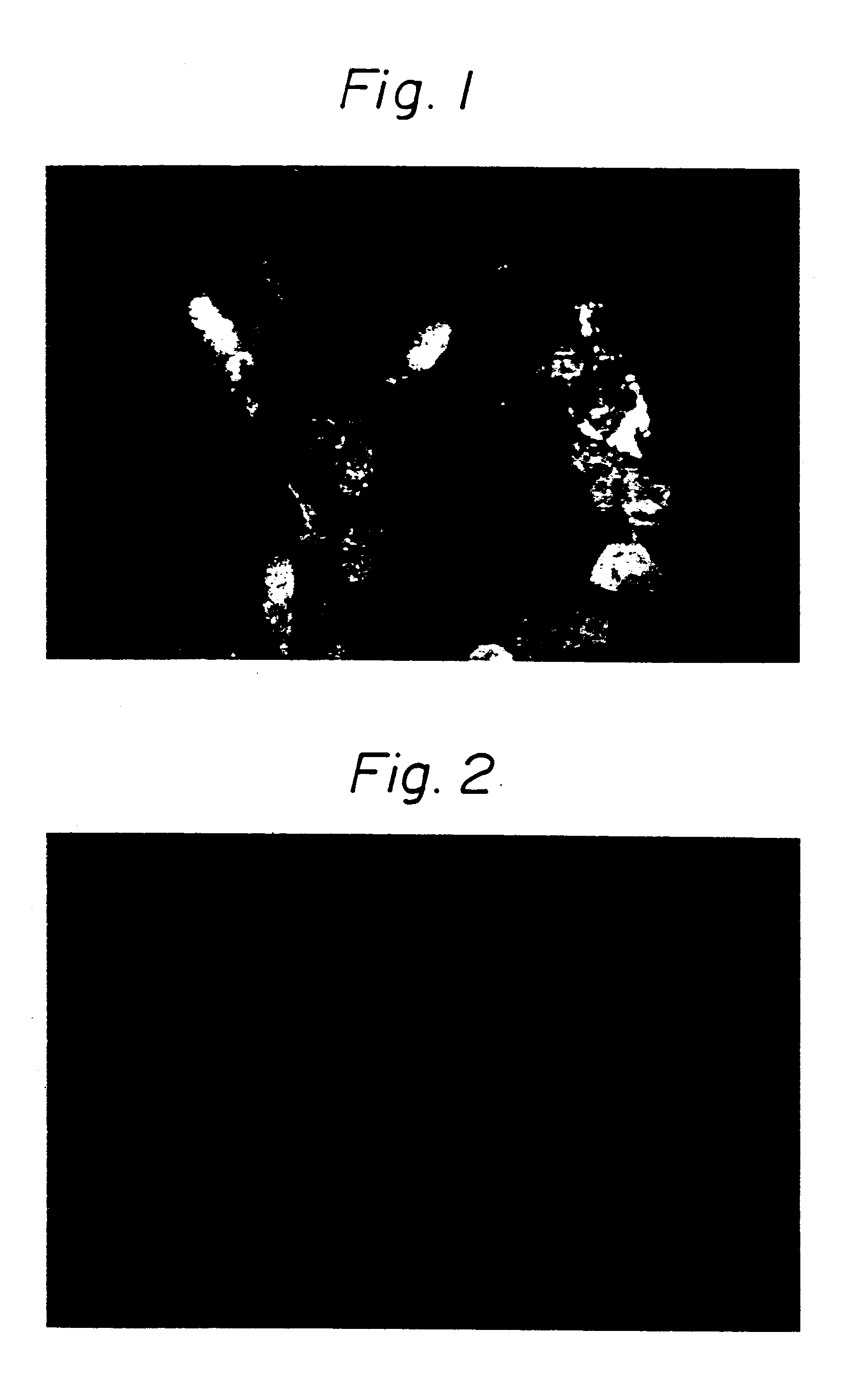 agent for and method of diagnosis of varicella zoster virus