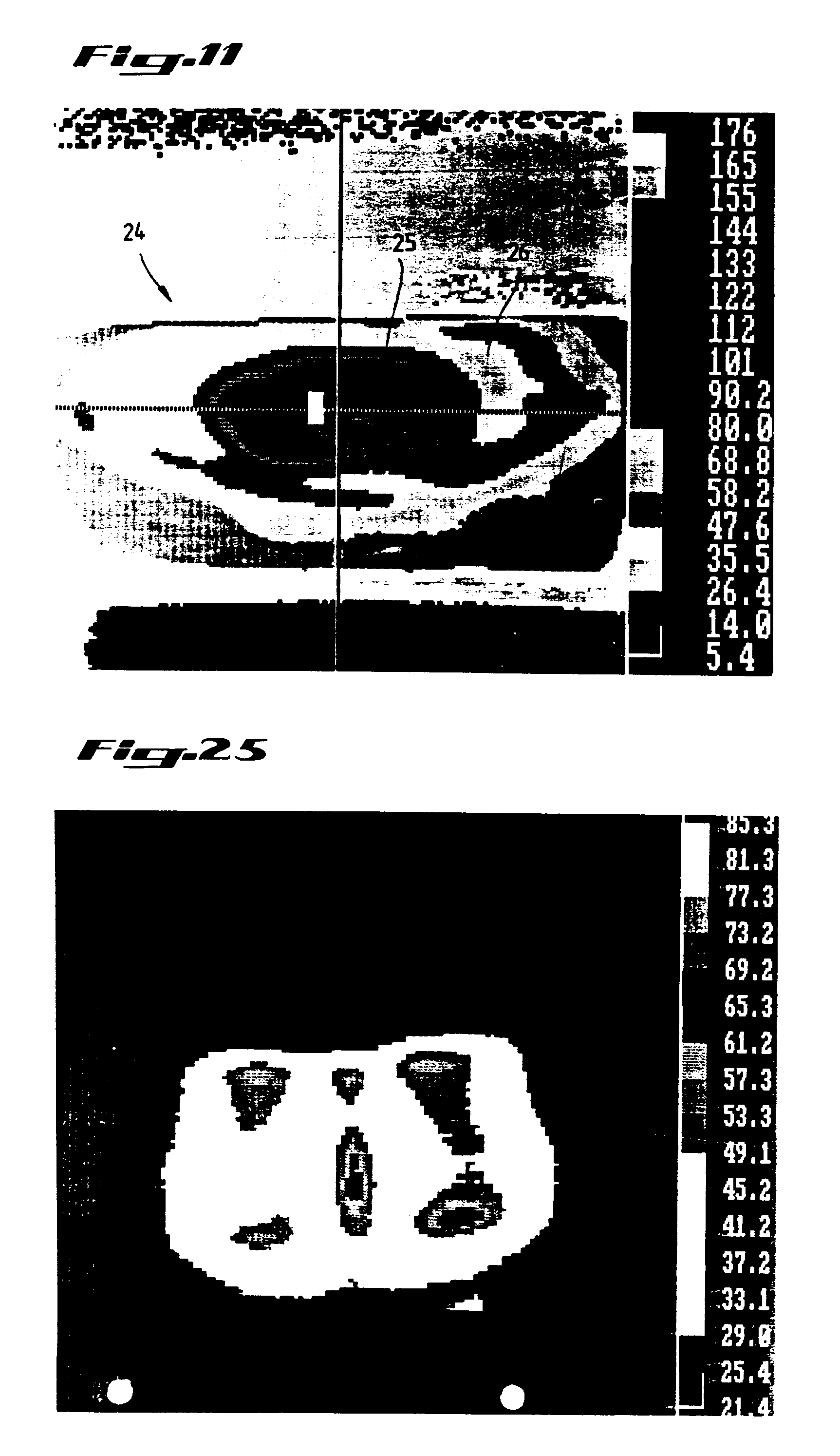 element de conditionnement a susceptance pour le