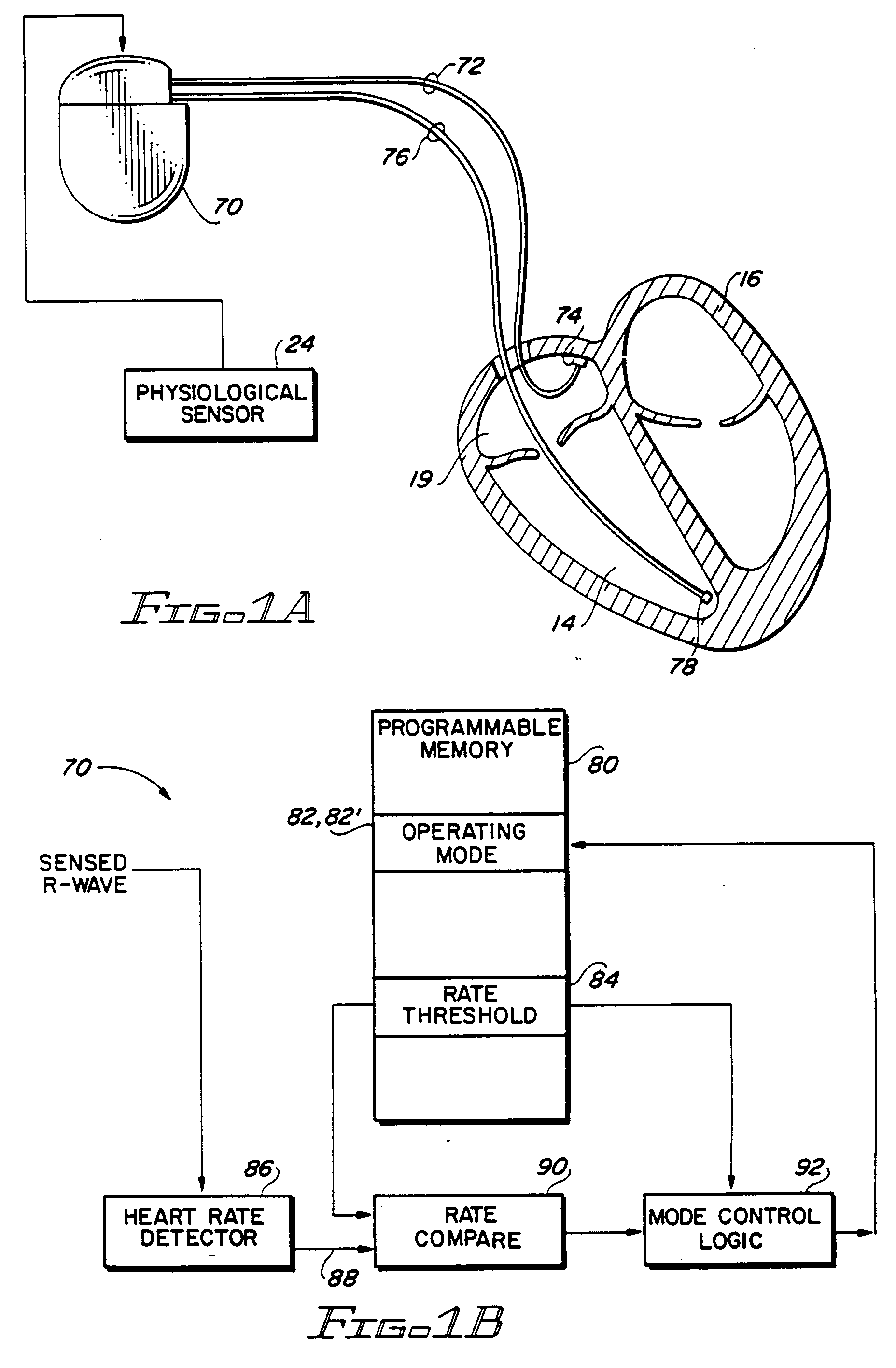 Patent EP0596540B1 Rateresponsive pacemaker with automatic mode