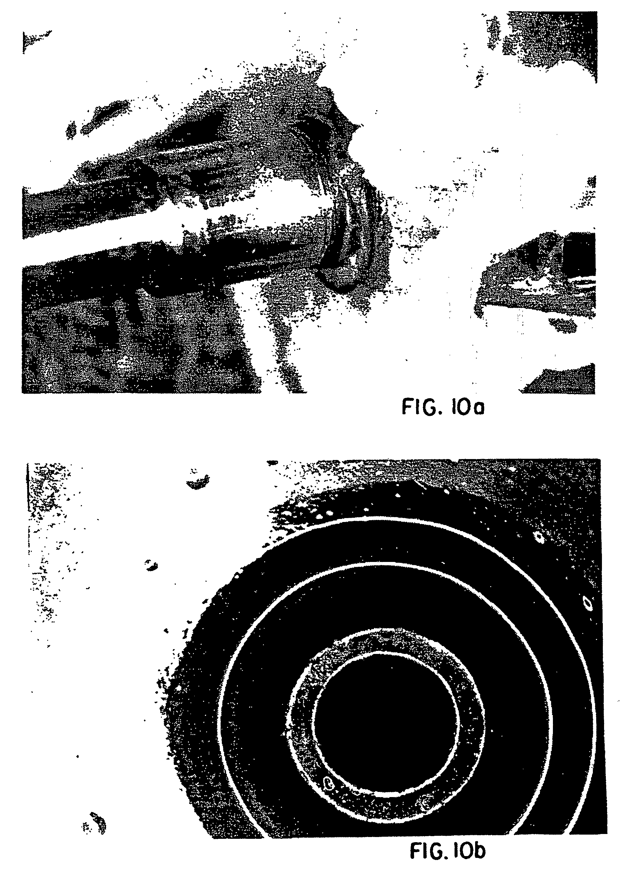 blood pump device and method for pumping blood of a patient