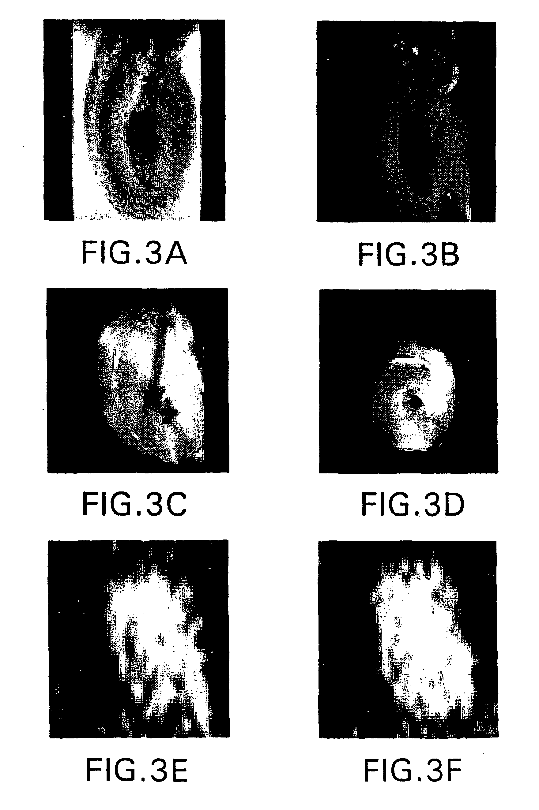utilisation comme agents de contraste des acides