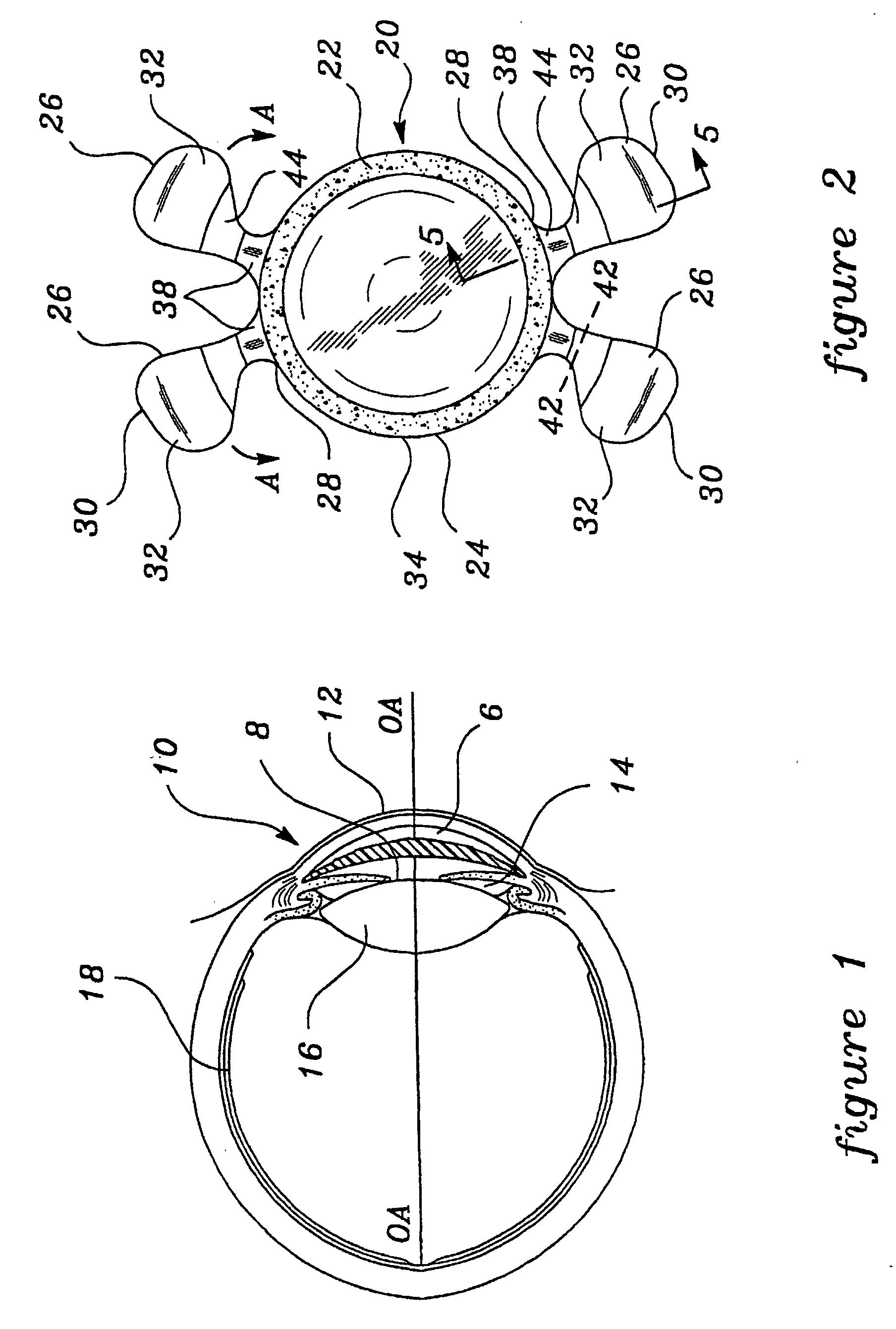 intraocular lens