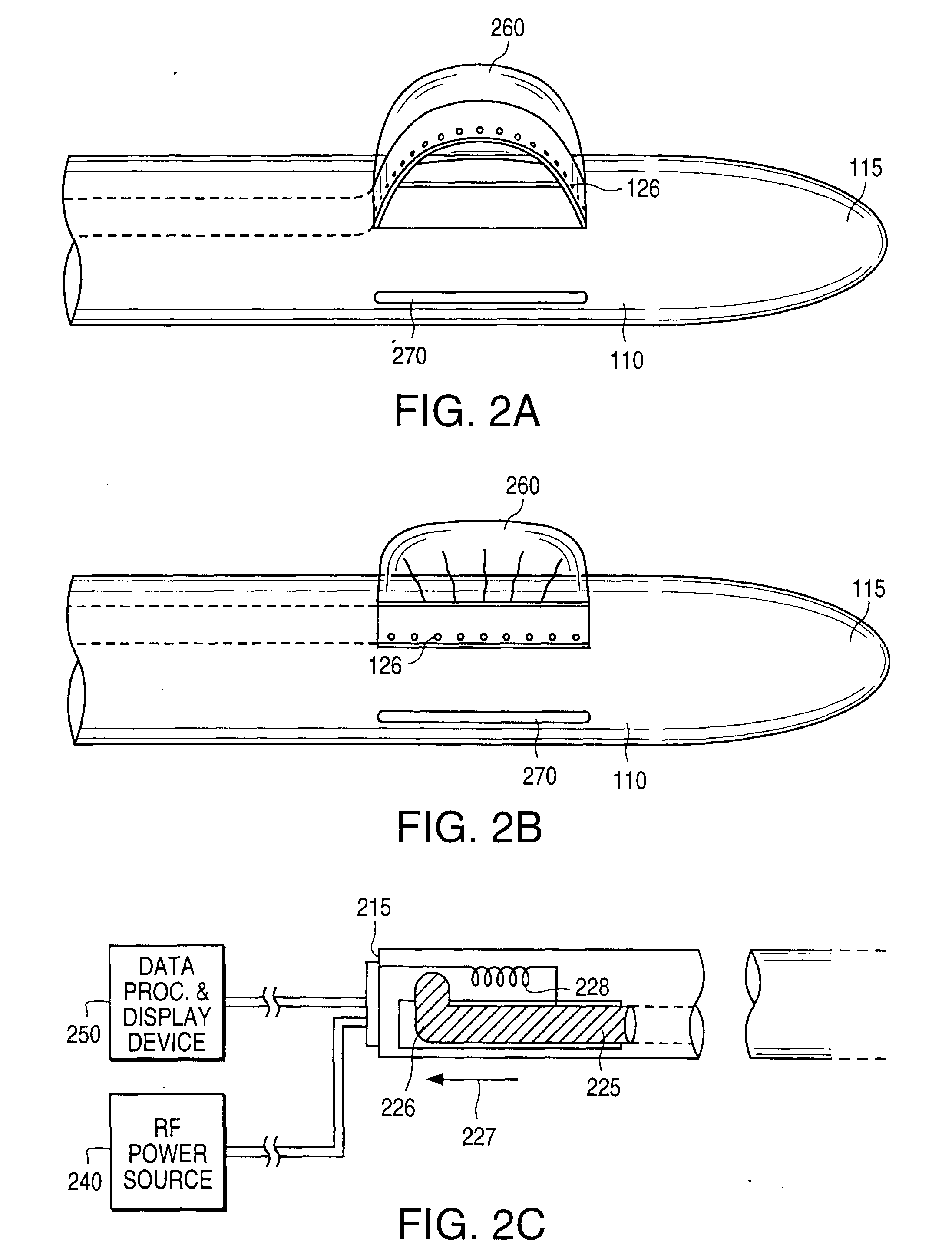 excisional biopsy devices and methods