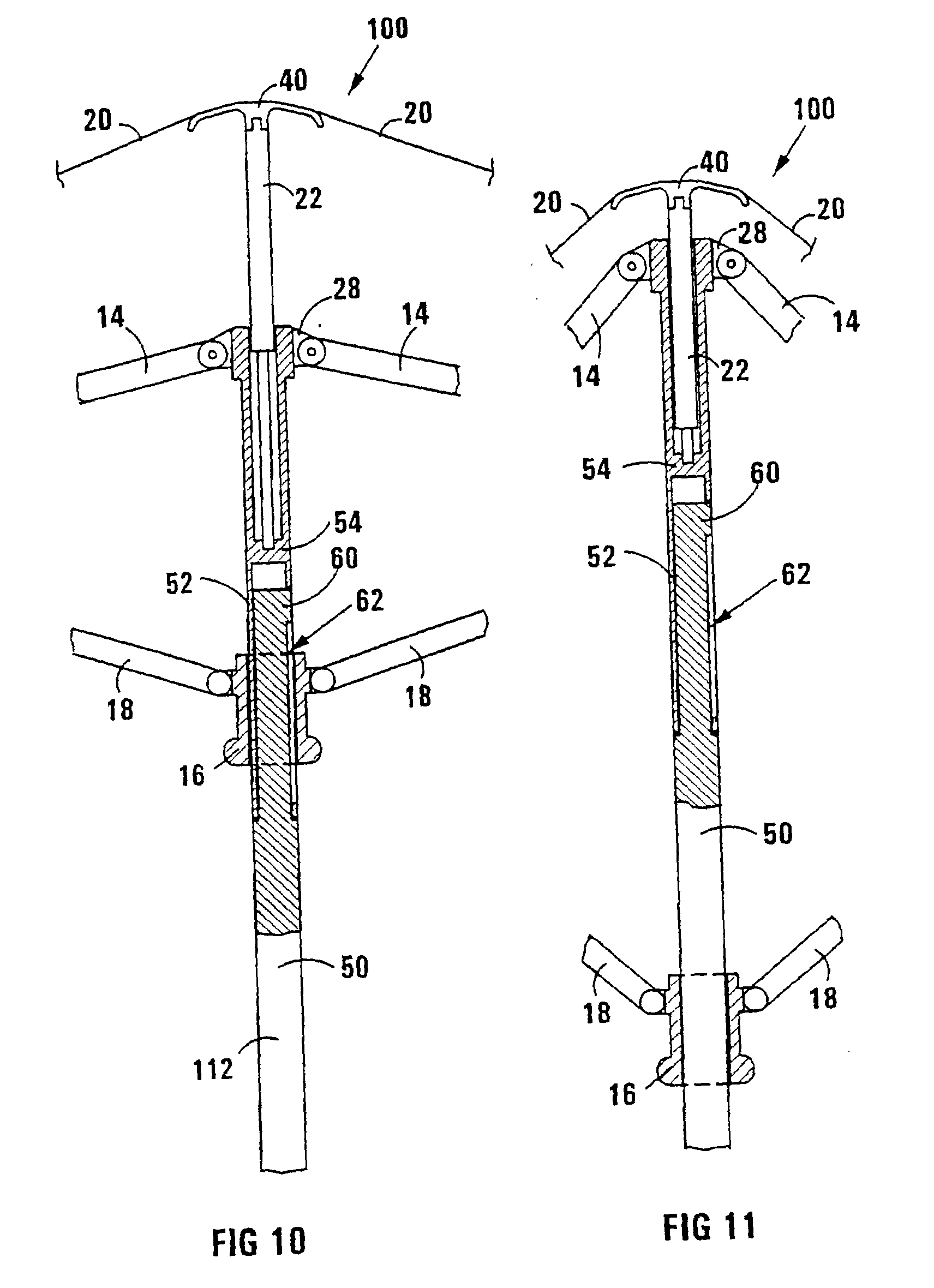 Offset Umbrella Parts Diagram