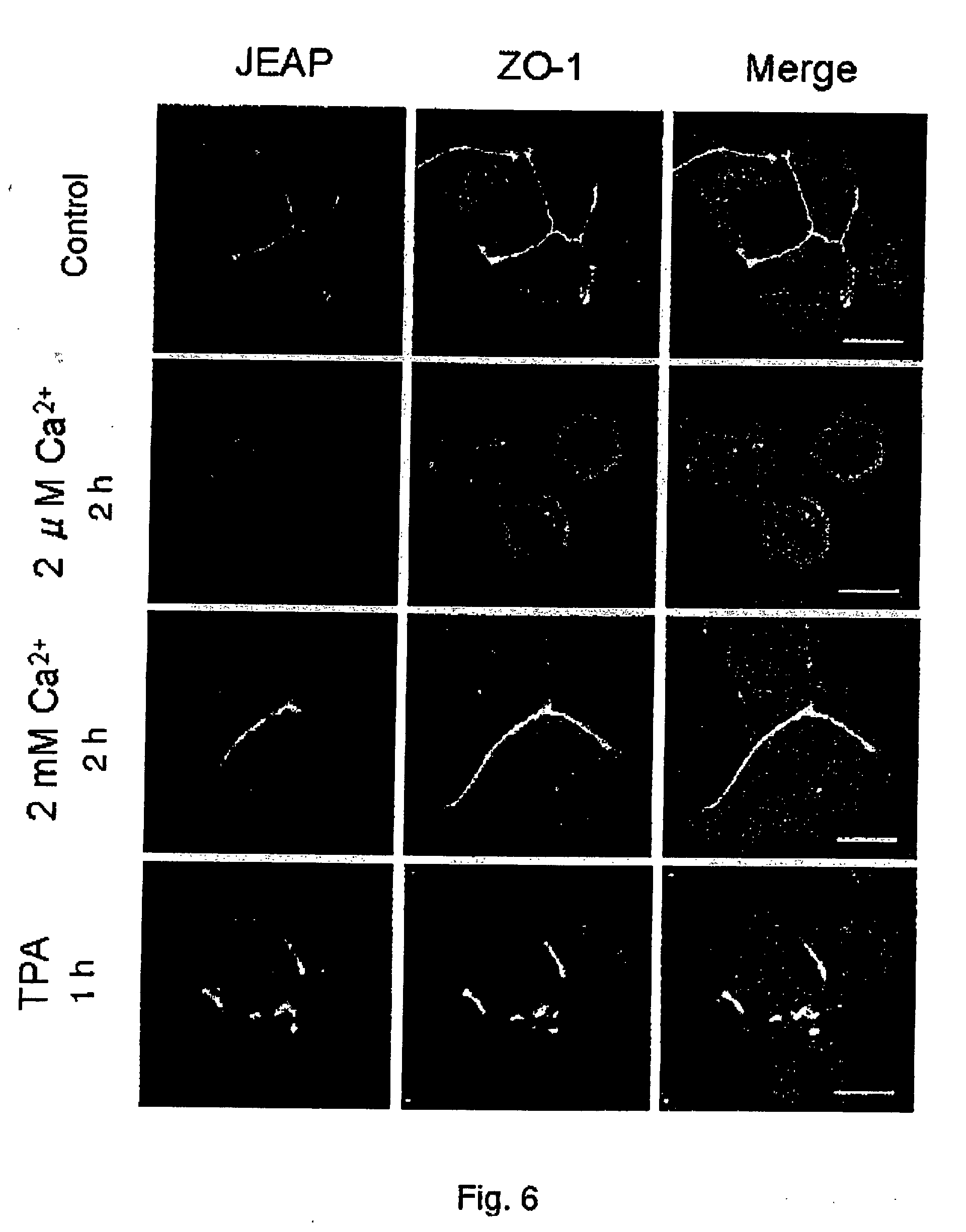 exocrine gland tight junction-constituting protein jeap family