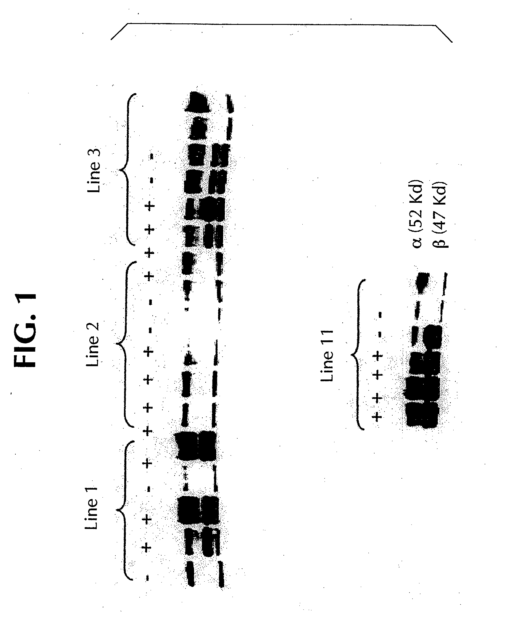 transgenic expression of glycogen synthase kinase 3 in muscle