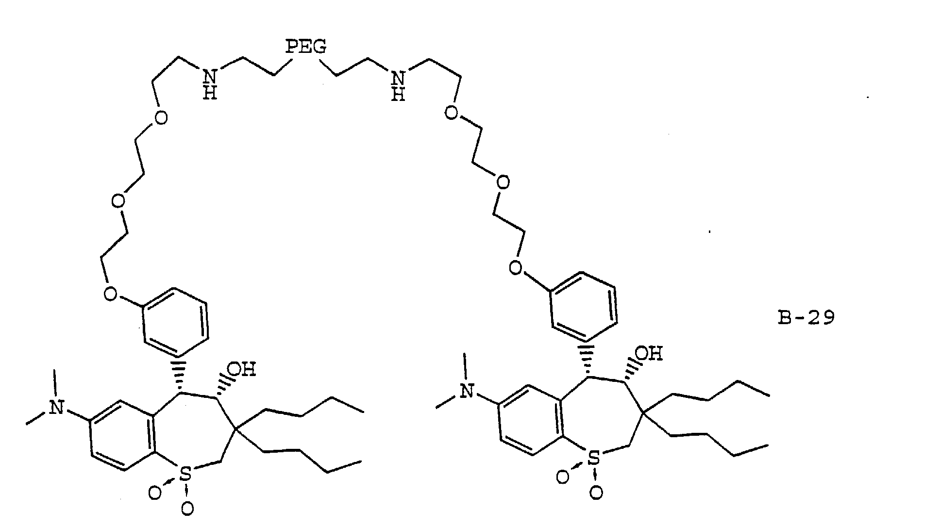 combinations of ileal bile acid transport inhibitors and fibric