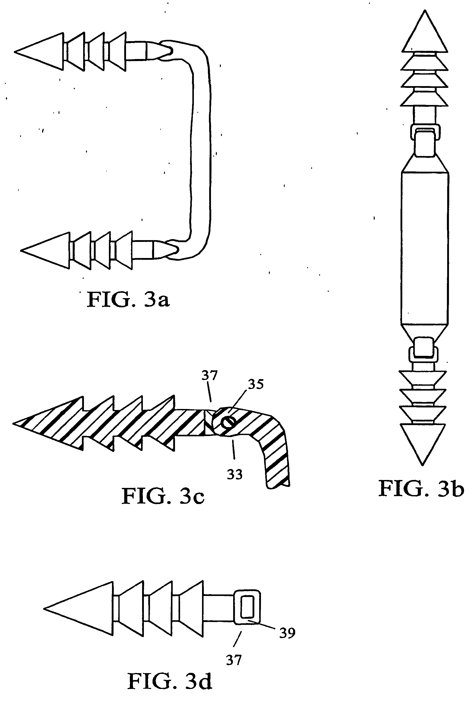 intervertebral connection system