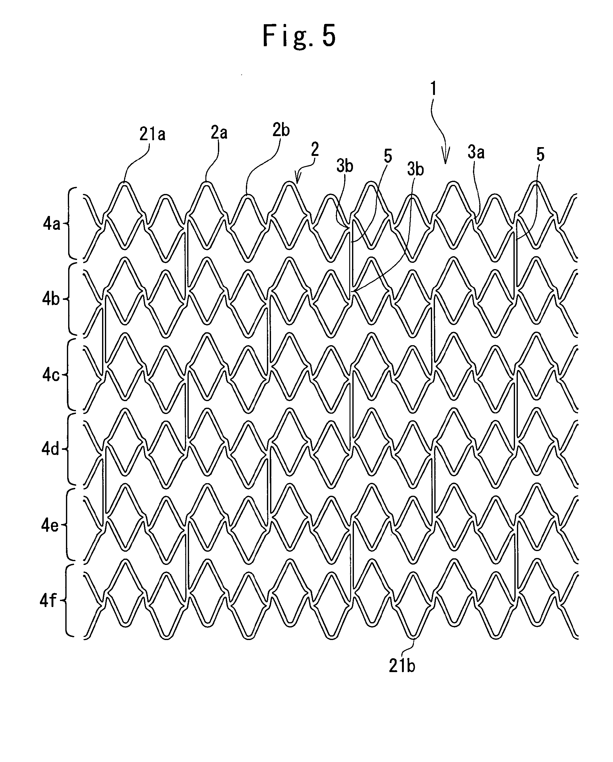 indwelling stent and vessel dilator
