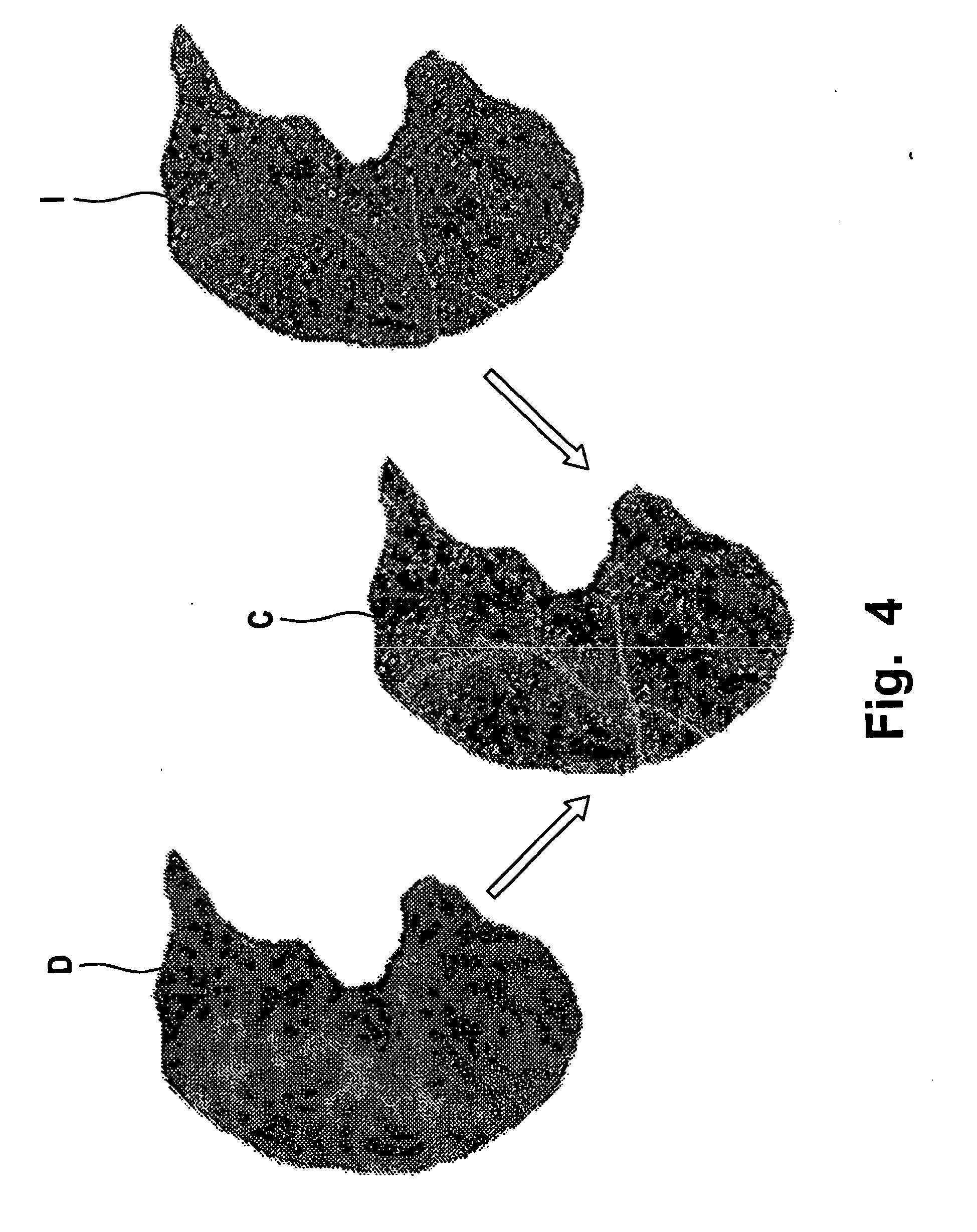 a method of lung lobe segmentation and computer system