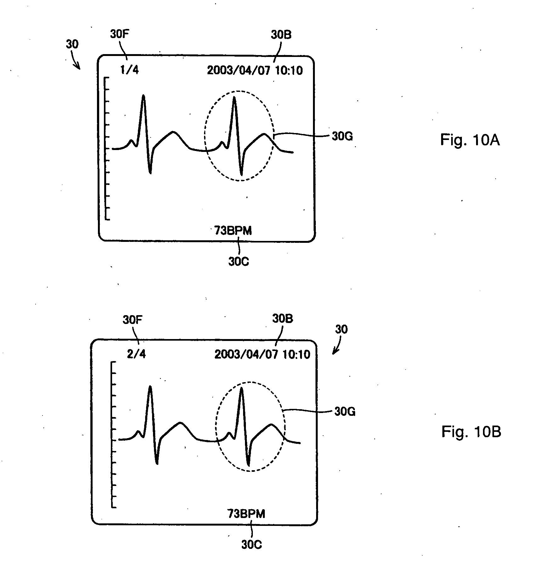 electrocardiograph and method of displaying electrocardiographic