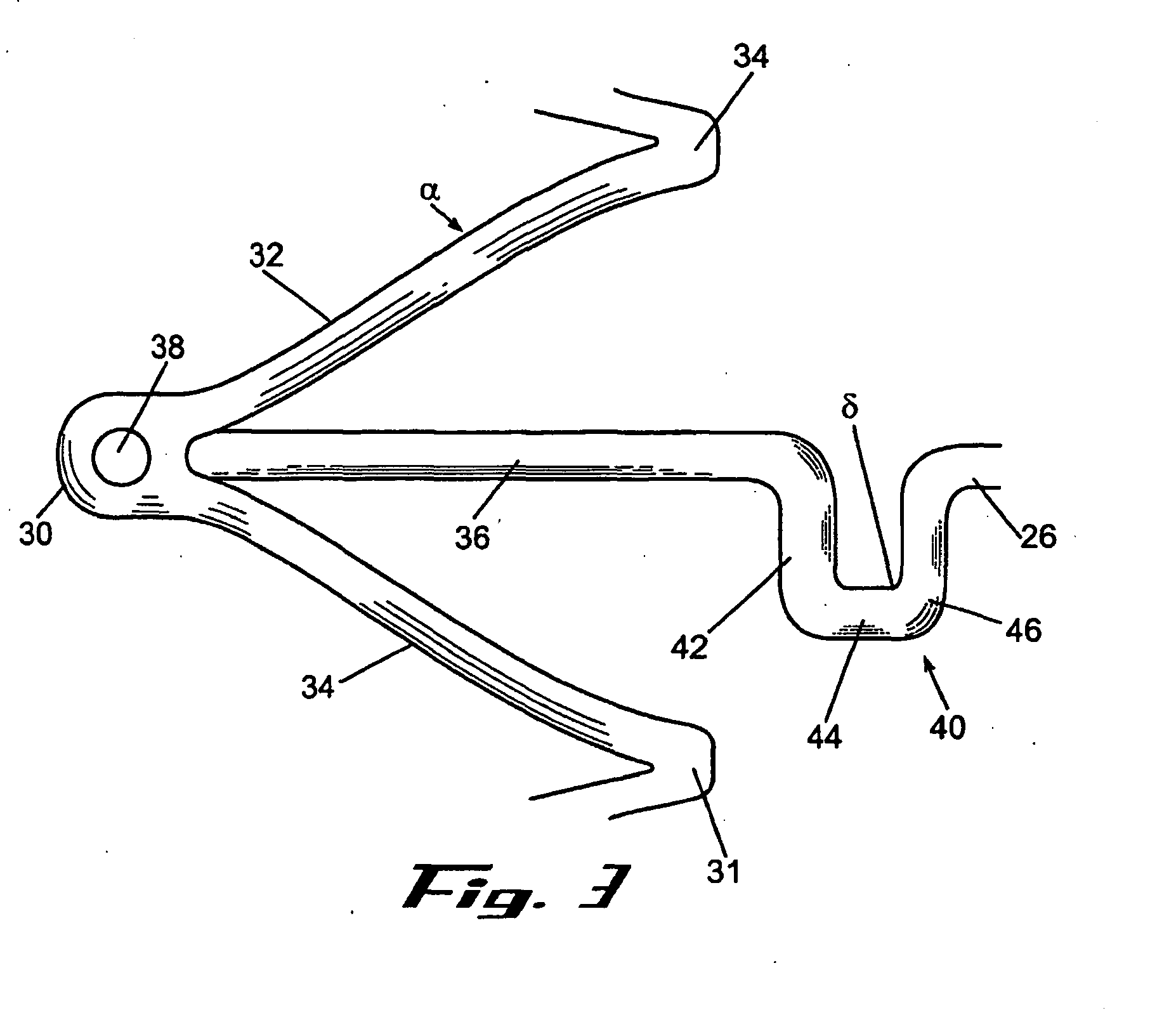 stent with geometry determinated functionality and method of