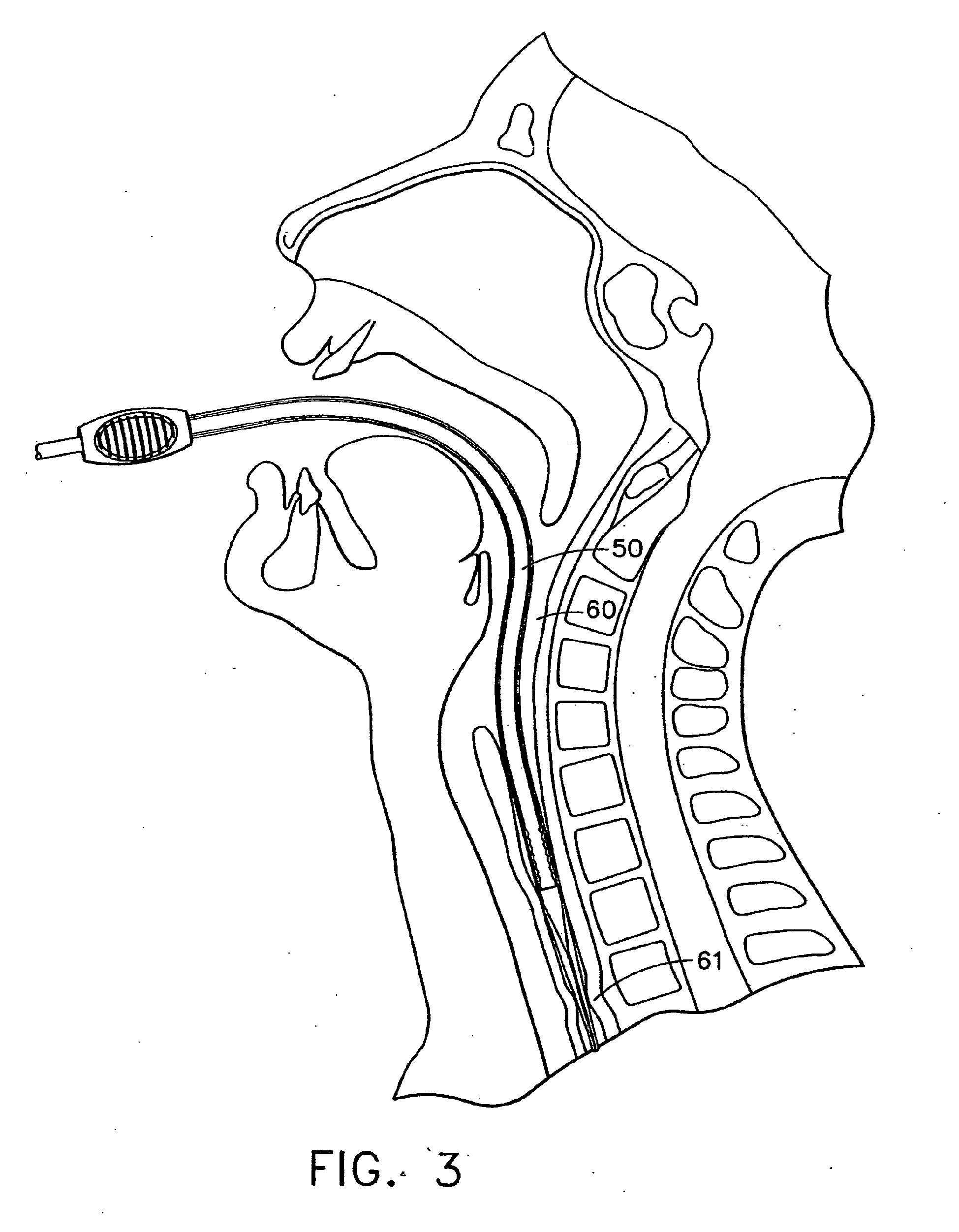 transparent dilator device